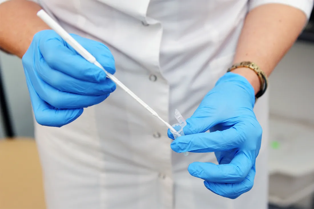 Cervical Cancer