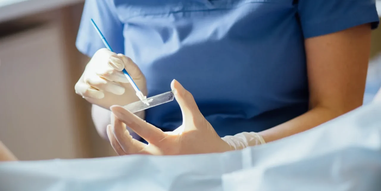 Abnormal Smear
