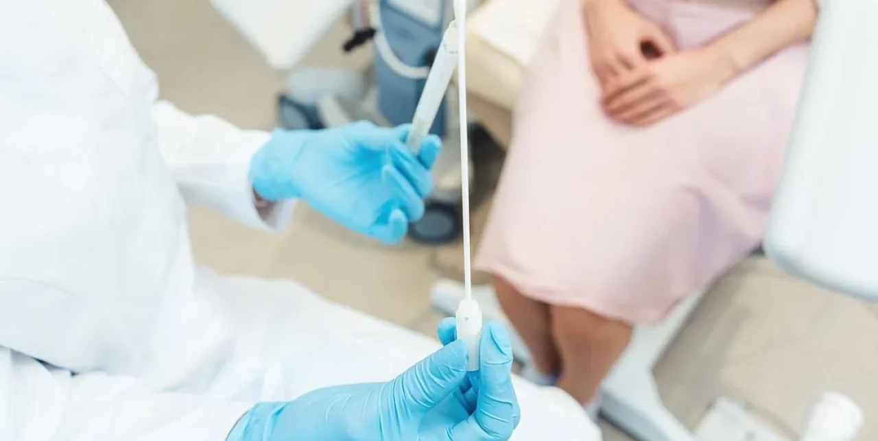 Cervical Smear Test Changes