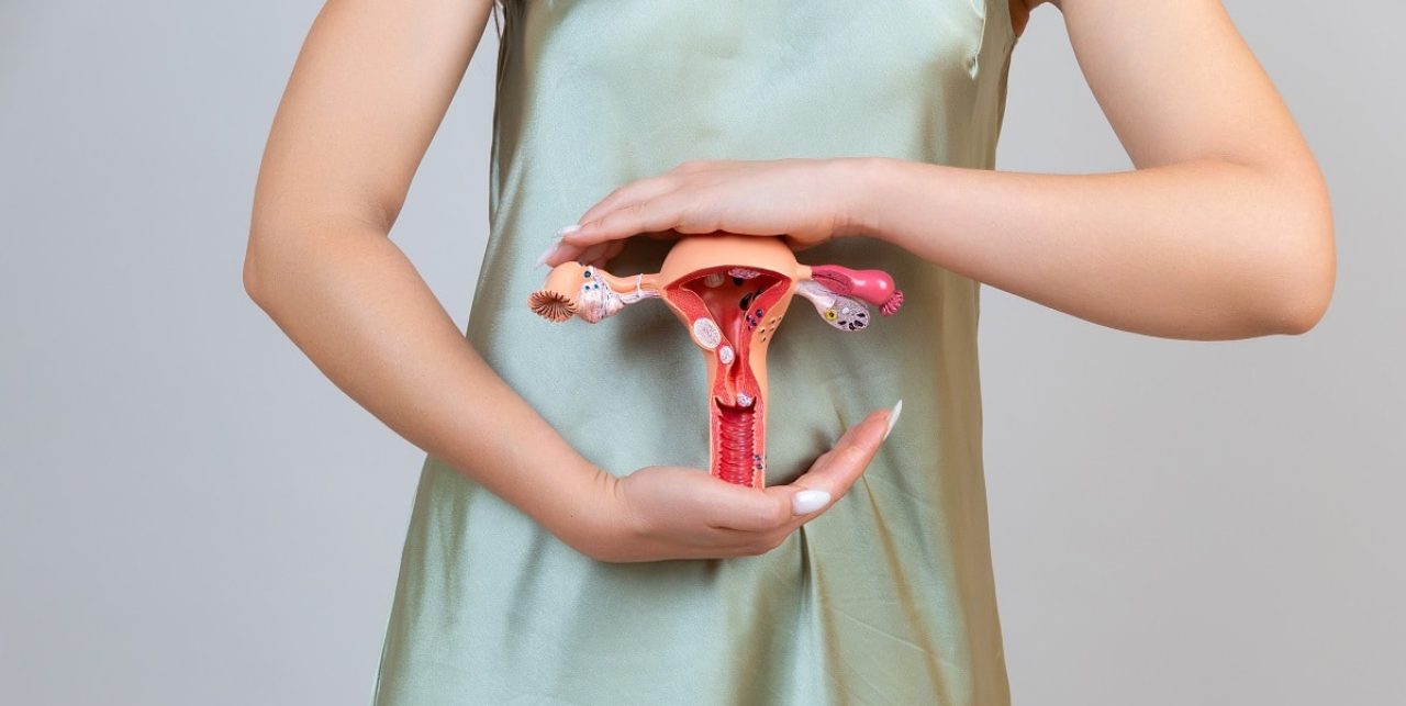 Endometriosis Image