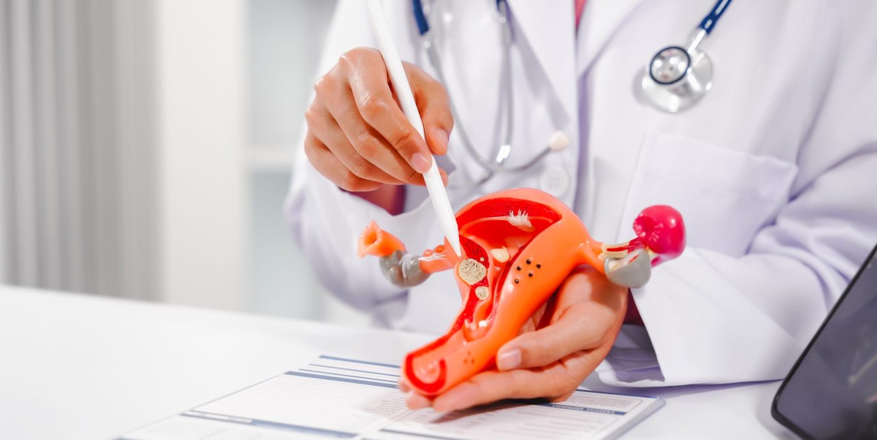 Fibroid Removal Procedure