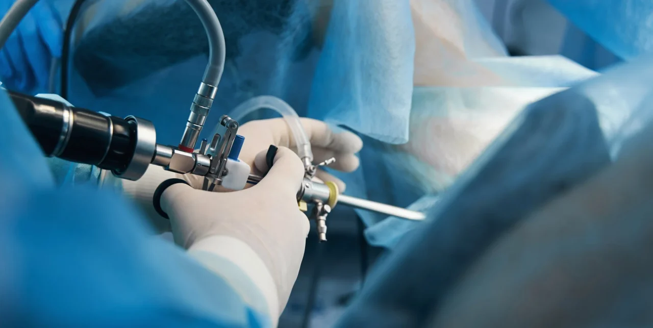 Hysteroscopy Procedure