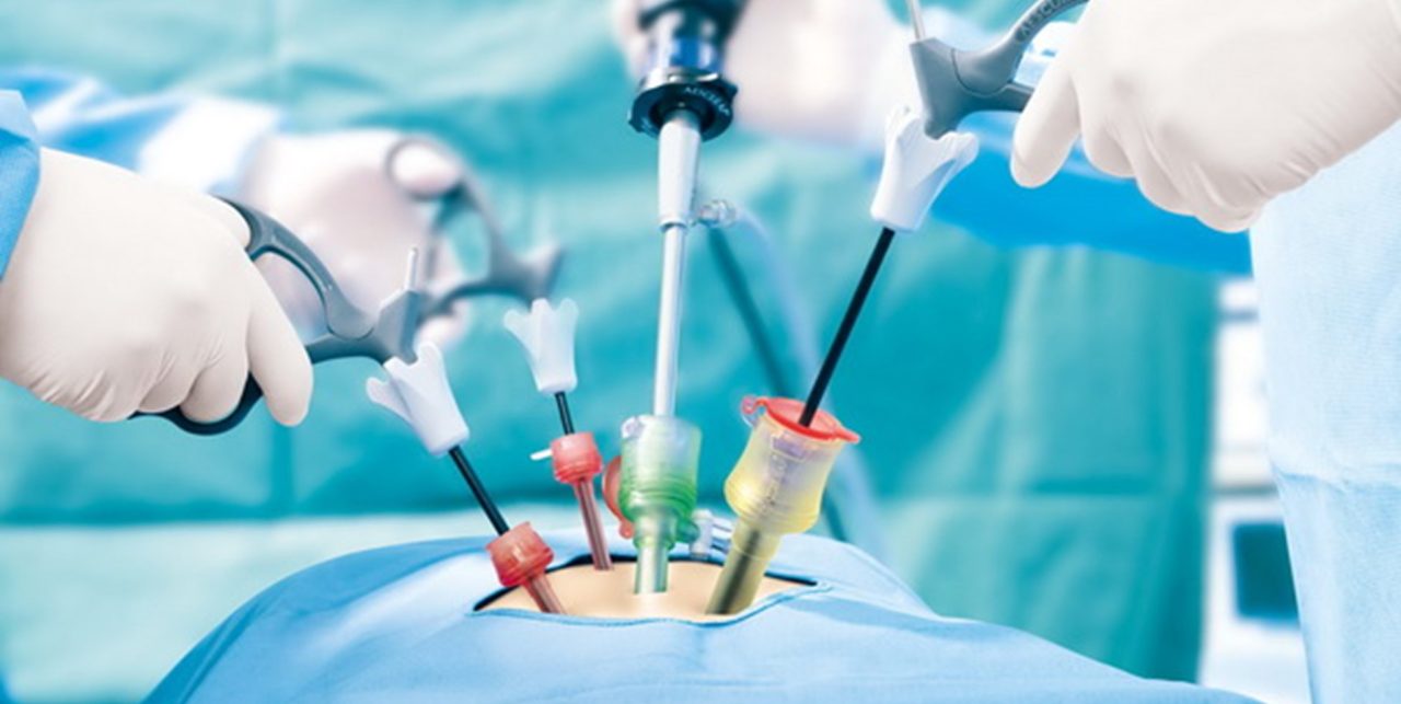 Laparoscopic Surgery