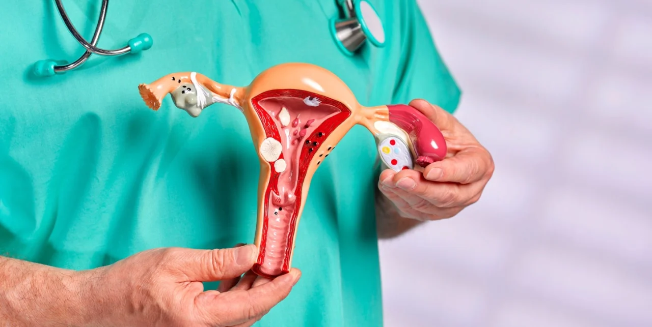 Uterus Cancer Image
